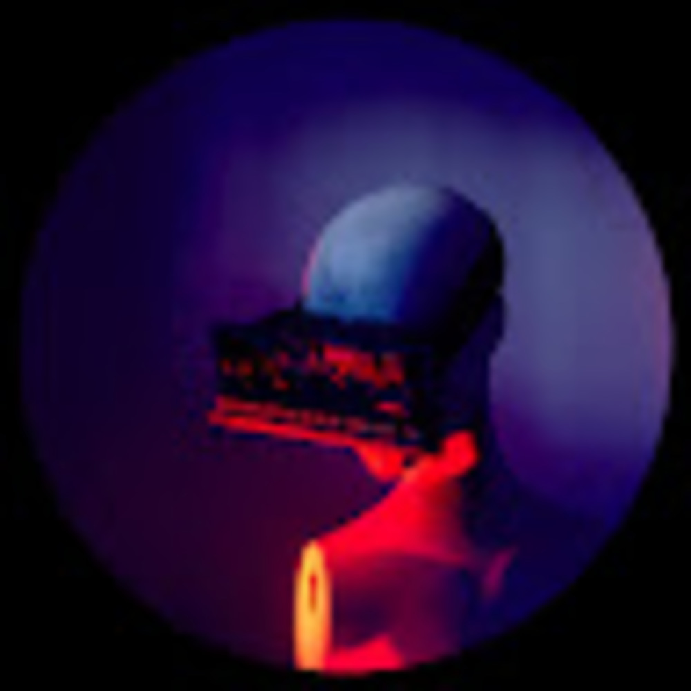 Meet your Posher, Treasure